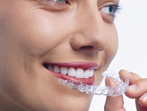 Sanfte Zahnkorrektur in jedem Alter